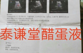 廉海鹰：泰谦堂醋蛋归元液调好了我的“多发性胆囊息肉、胆囊炎、肾囊肿”！