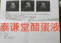廉海鹰：泰谦堂醋蛋归元液调好了我的“多发性胆囊息肉、胆囊炎、肾囊肿”！
