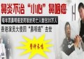 张洪江：家族性高血压、牛皮癣、过敏性鼻炎、脂肪瘤、子宫肌瘤！