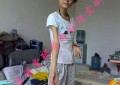 全身肌肉萎缩、肌无力案例！